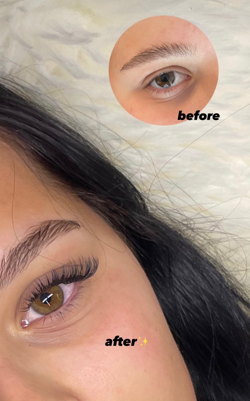 Before After Ergebnis