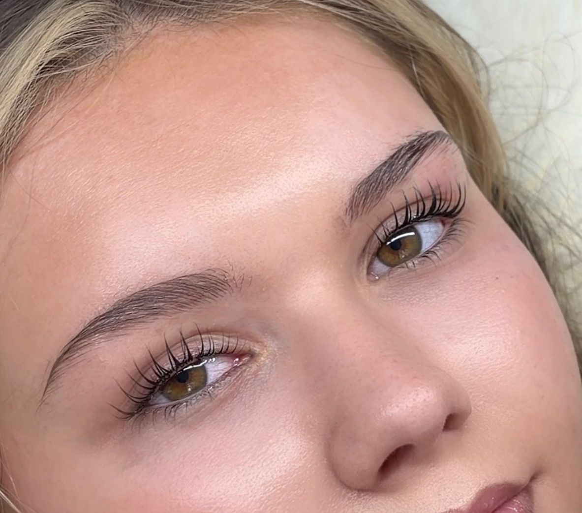 Brow Lift Ergebnis